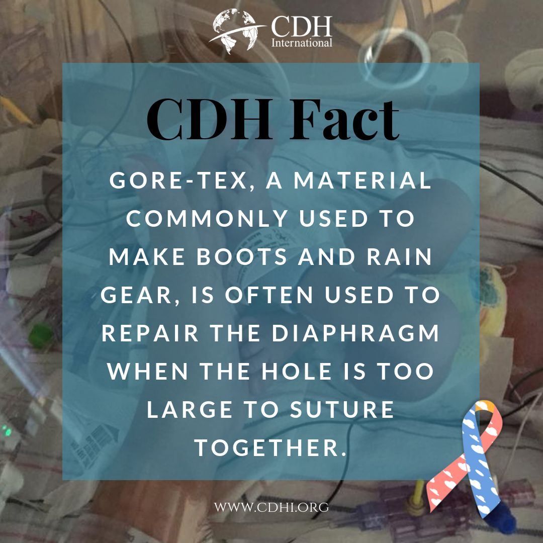 CDH Awareness Month Trivia – Day 27