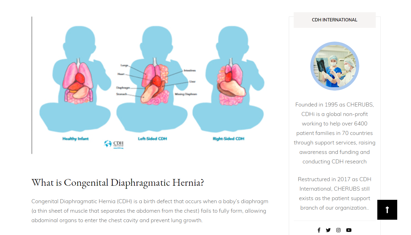 CDH Research International - A Global Initiative to Stop Congenital ...