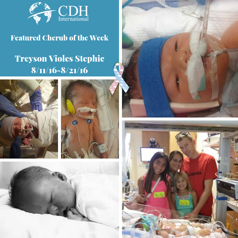 Make A Tax-Deductible Donation to Fight Congenital Diaphragmatic Hernia