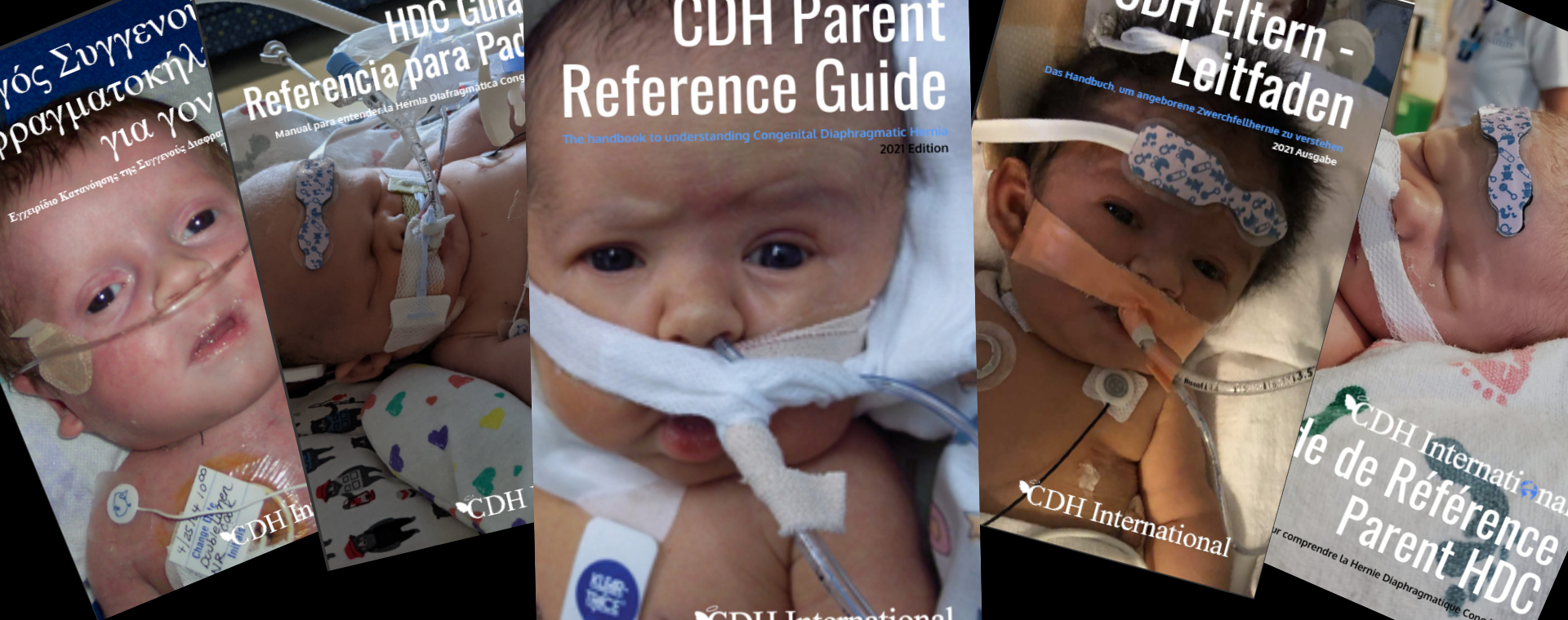 Cdh International A Global Initiative To Stop Congenital Diaphragmatic Hernia