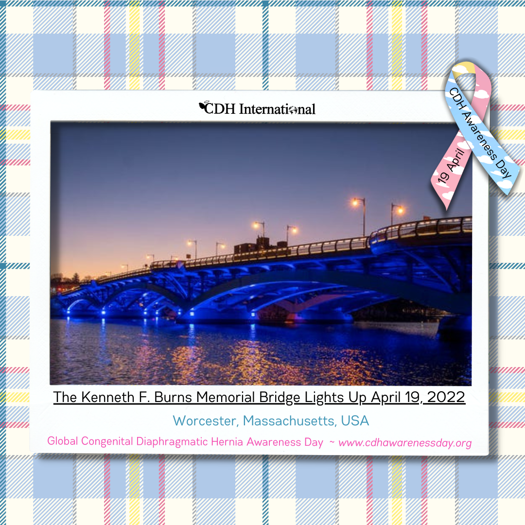 The Leonard P. Zakim Bunker Hill Memorial Bridge Lights Up For CDH Awareness