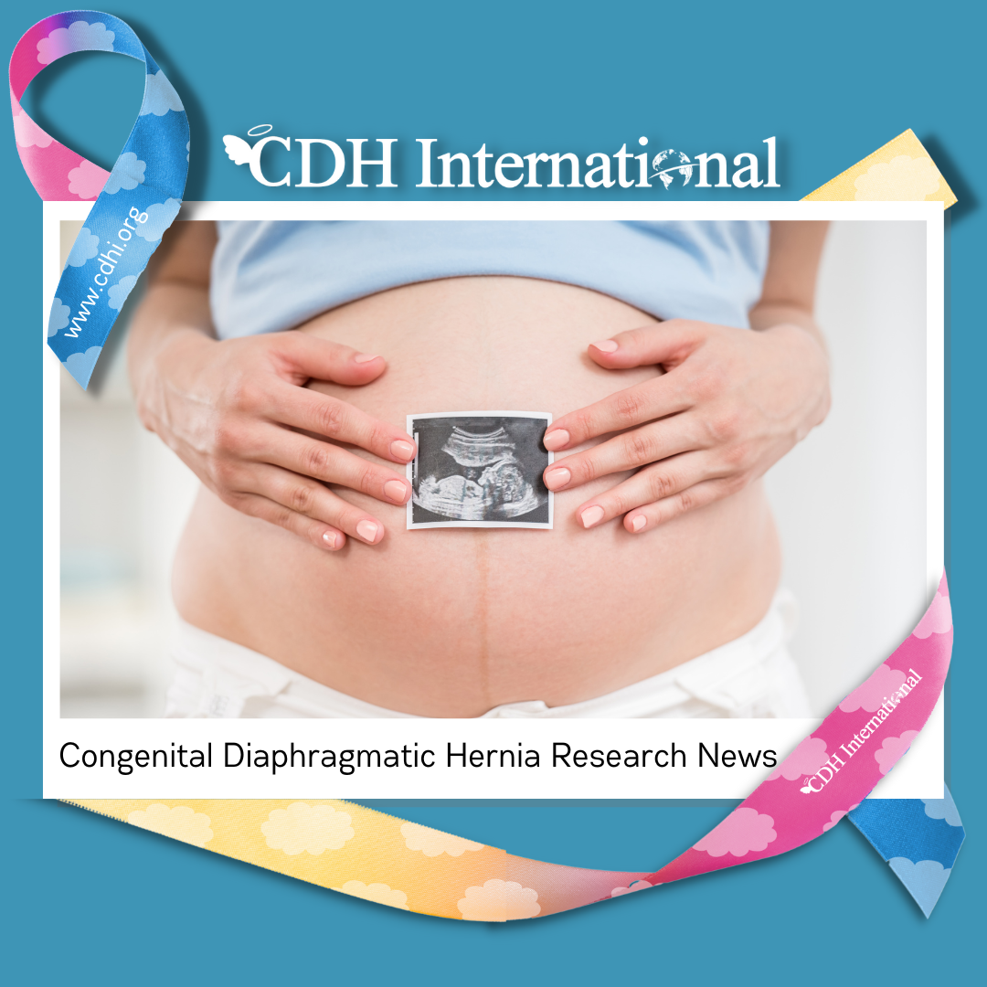 Research: Spontaneous breathing approach in mild congenital diaphragmatic hernia: A resuscitation algorithm