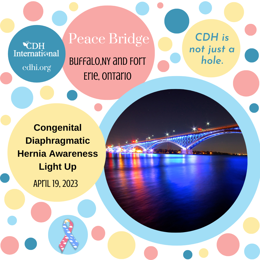 The CN Tower Lights Up For CDH Awareness