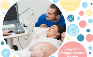 Research: Inotropic score and vasoactive inotropic score as predictors of outcomes in congenital diaphragmatic hernia: A single center retrospective study