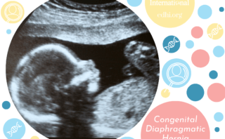 Research: Lung Ultrasound Score in Neonates with Congenital Diaphragmatic Hernia (CDH-LUS): A Cross-Sectional Study