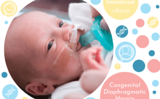 Research: Stem cell therapies for neonatal lung diseases: Are we there yet?