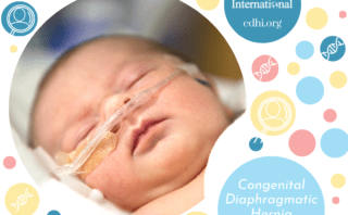 Research: Beyond the diaphragm and the lung: a multisystem approach to understanding congenital diaphragmatic hernia