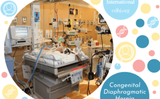 Research: Congenital diaphragmatic hernia survival in an English regional ECMO center