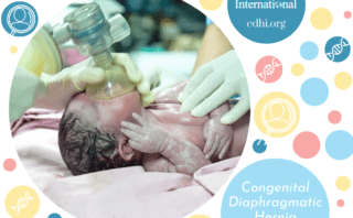 Research: Congenital diaphragmatic hernia: exploring the intersection of personal experience and research