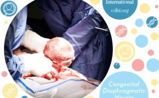 Research: Unique Cardiopulmonary Interactions in Congenital Diaphragmatic Hernia: Physiology and Therapeutic Implications