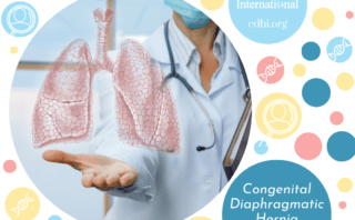 Research: Pulmonary Artery Measurements as Postnatal Prognostic Tool in Right Congenital Diaphragmatic Hernia