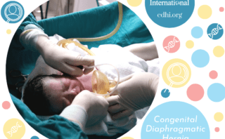Research: Prevalence and early surgical outcome of congenital diaphragmatic hernia in the Netherlands: a population-based cohort study from the European Pediatric Surgical Audit