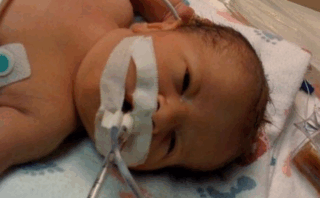 Research: Overall outcome of the prenatally diagnosed left isolated congenital diaphragmatic Hernia – a report from the Japanese CDH study group