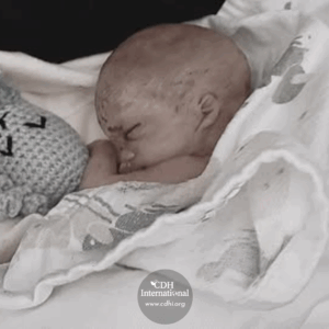 Fundraising 2024 Instagram FB Post Square Graphics for CDHi (18)