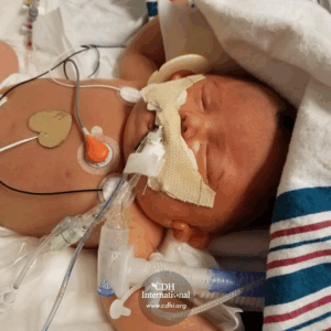 Fundraising 2024 Instagram FB Post Square Graphics for CDHi (21)