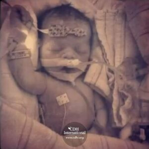 Fundraising 2024 Instagram FB Post Square Graphics for CDHi