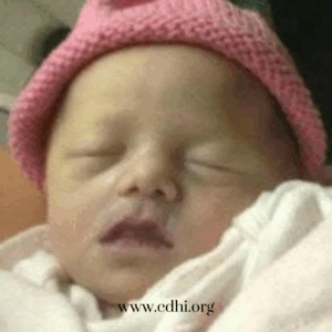 Close-up of a sleeping newborn wearing a pink knitted hat, wrapped in a white blanket.